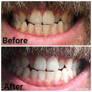 Whitening Toothpaste!!